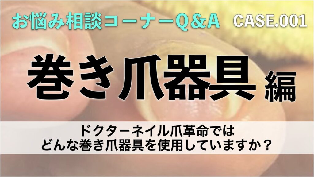 特許よりも大事なのは使い分け！巻き爪器具を8種揃えるドクターネイルの理由とは？