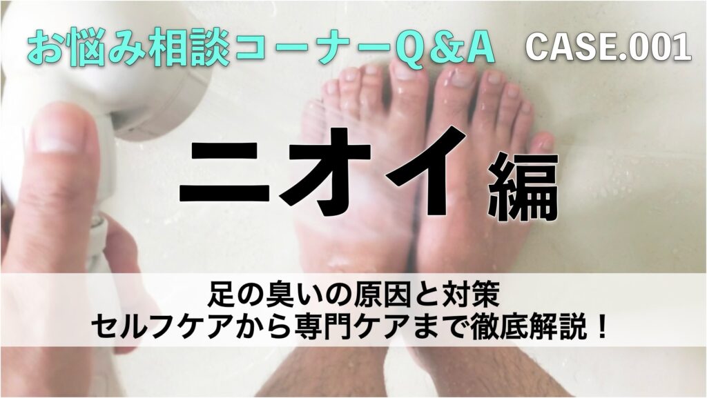足の臭いの原因と対策｜セルフケアから専門ケアまで徹底解説！
