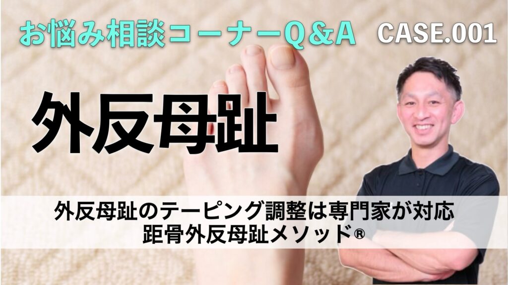 外反母趾のテーピング調整は専門家が対応｜ドクターネイル爪革命の距骨外反母趾メソッド®︎