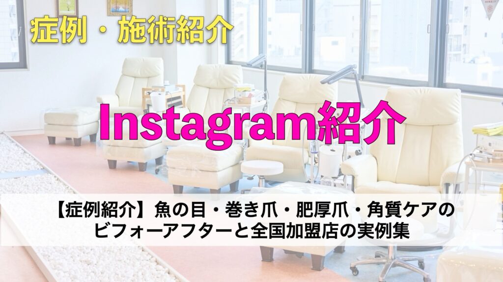 【症例紹介】魚の目・巻き爪・肥厚爪・角質ケアのビフォーアフターと全国加盟店の実例集