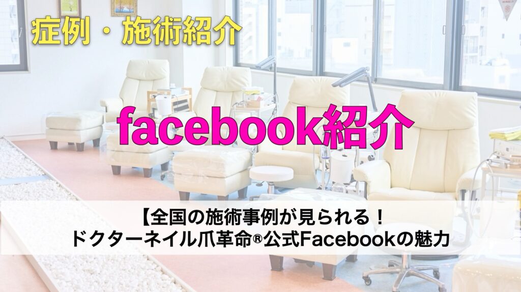 全国の施術事例が見られる！ドクターネイル爪革命®公式Facebookの魅力