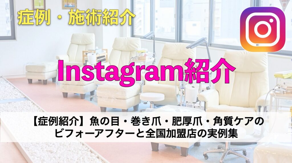 【症例紹介】魚の目・巻き爪・肥厚爪・角質ケアのビフォーアフターと全国加盟店の実例集
