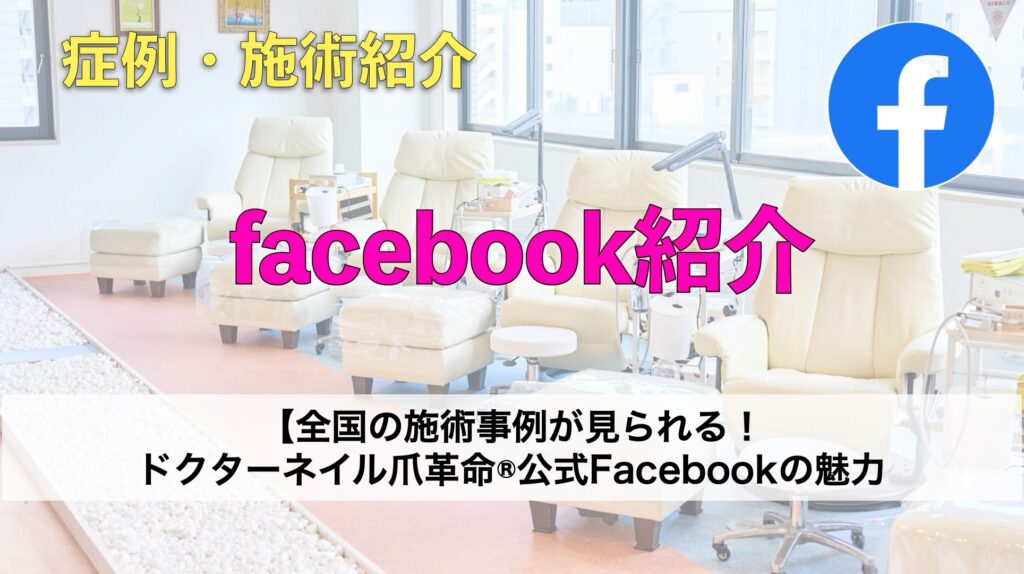 全国の施術事例が見られる！ドクターネイル爪革命®公式Facebookの魅力