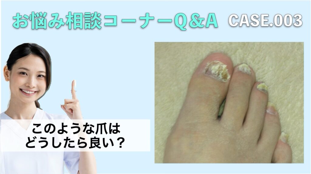 お悩み相談 CASE.003